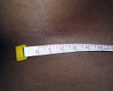 Breast augmentation scar photos marks102.JPG