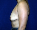 profile-photo-before-implant-157.JPG