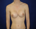 Symmastia pictures photo_syn315.JPG