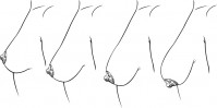 nipple positions for breast augmentation