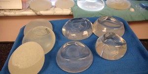 Breast Implants