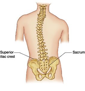 body shape breast augmentation photos