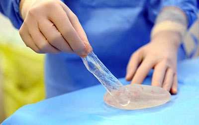 breast implant life expectany silicone gel