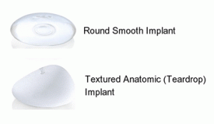 breast implant rotation virginia
