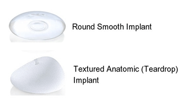 breast implant rotation virginia